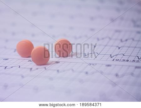 Holter electrocardiogram trace of a patient with pacemakers and some colored pills