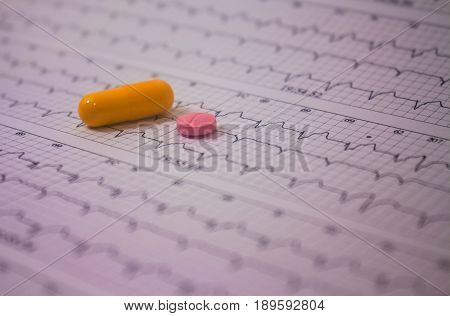 Holter electrocardiogram trace of a patient with pacemaker and some colored pills