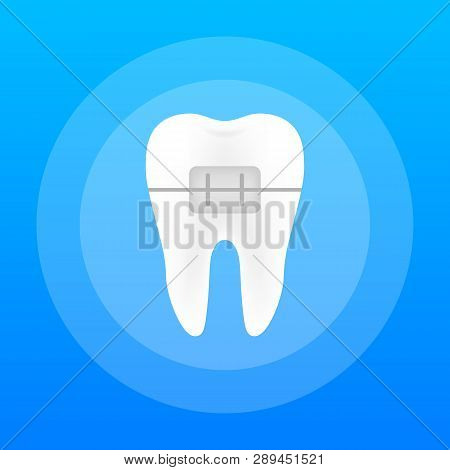 Correction Of Teeth With Orthodontic Braces. Stages Of Teeth Alignment. Dental Clinic Services. Vect