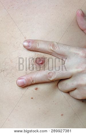 Male Hairy Nipple. Nipple With Hair. Easy Erotica And Humor. Without Epilation. Male Hand. Bdsm