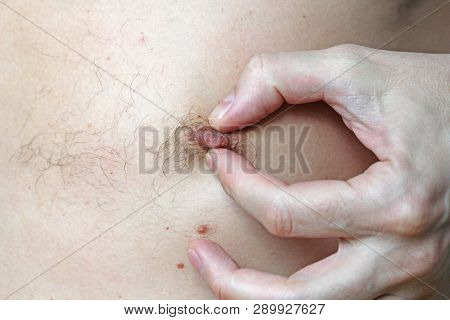 Male Hairy Nipple. Nipple With Hair. Easy Erotica And Humor. Without Epilation. Male Hand. Bdsm