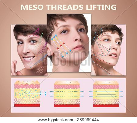 meso lifting face & body main image 0