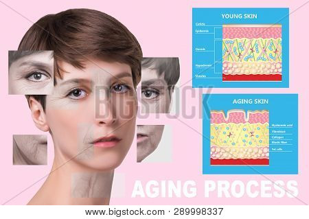 The Younger Skin And Aging Skin. Elastin And Collagen. A Diagram Of Young And Old Face Showing The D
