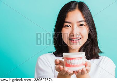 Portrait Of Asian Teen Beautiful Young Woman Smile Have Dental Braces On Teeth Laughing She Holding 