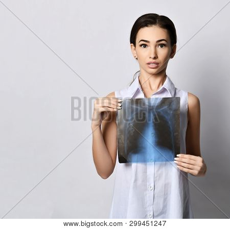 Slim Puzzled Brunette Woman Hold Lungs X-ray Examination Of Chest In Front Of Her On Gray Background